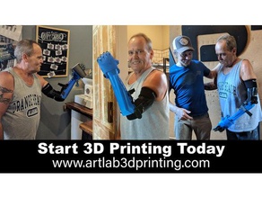 kevins protesica alfie 21 altri personalizzato 3d print model - Mito3D