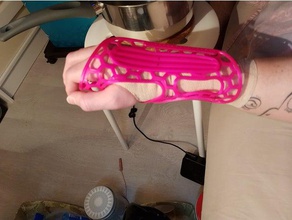 Handgelenk band andere die medizinische Armband 3d print model - Mito3D