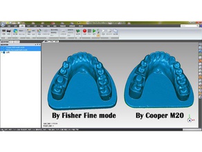 diente otros 3d print model - Mito3D