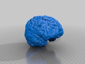 brains biology mri 3d print model - Mito3D