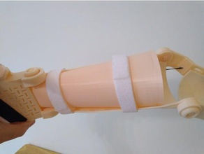 flexible arm filler insert unlimbited alfie robotics e-nable team 3d print model - Mito3D