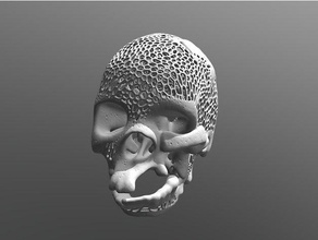 skull facial malformation voronoi scans replicas anatomy human threacher-collins 3d print model - Mito3D