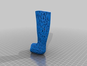 une jambe dans le plâtre les gens 3d print model - Mito3D