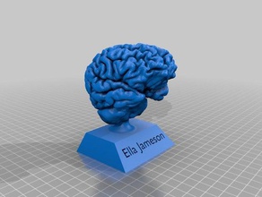 my brain mri scan 3d print model - Mito3D