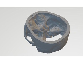 skull base learning anatomical models anatomy brain neurology neuroscience neurosurgery 3d print model - Mito3D