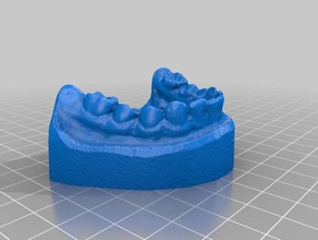 set teeth dental model 3d scan test raspi cam scans replicas scanner scanning anatomy dentist dentistry medical 3d print model - Mito3D