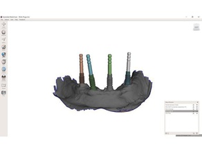 plusieurs unités de pilier plug la biologie dentaire les implants dentaires 3d print model - Mito3D