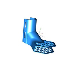 canard pied médicale cast remix - crossfit édition de l'étape fichier accessoires le chaussure étape 3d print model - Mito3D