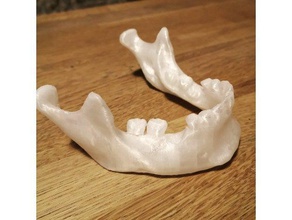 3d insan mandibula çene kemiği taranmış biyoloji anatomi antropoloji kemik osteoloji bilim iskelet 3d print model - Mito3D