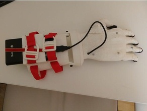 robotic hand - working prosthesis arduino nrf24l01 prosthetic stop tech-1 x-axis x-one2 3d print model - Mito3D