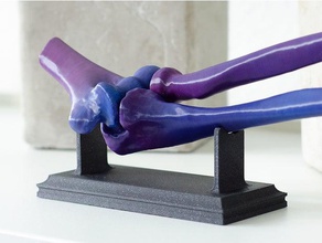 elbow joint ct-scan biology anatomy bones ctscan medical 3d print model - Mito3D
