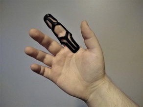 moldable finger splint medical 3d print model - Mito3D