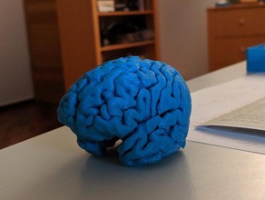 my brain 3d print model - Mito3D