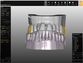 zirkonzahn Krone mua Implantat-Brücke 3d-Drucker 3d-drucken dental Zahnarzt Zahnmedizin Bildung die medizinische medizinischen Geräten 3d print model - Mito3D