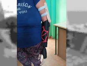 hope 1 prosthesis left arm based flexy hand form jorge 3d print model - Mito3D