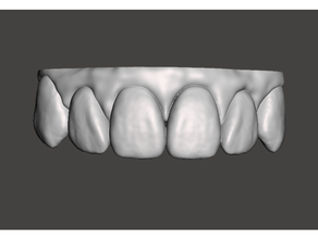 dentaire modèle dents partie prêt imprimer 3d print model - Mito3D