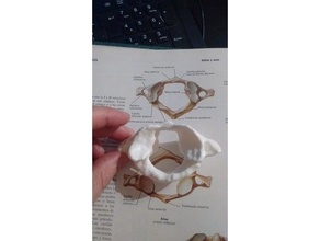 columna cervical radiologia anatomia traumatologia 3d print model - Mito3D