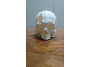 cr neo fractura en hueso frontal tomograf computada anatomy neurology 3d print model - Mito3D