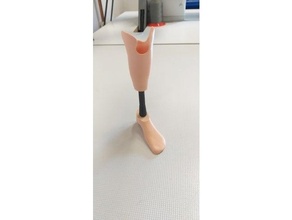 arto protesica protesi 3d print model - Mito3D