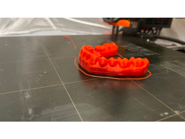gerçekçi diş model gerçek 3D print model - Mito3D