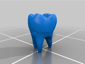 humano dente modelo reparado 3d print model - Mito3D