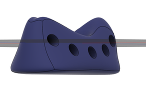 prostate cradle 3d print model - Mito3D