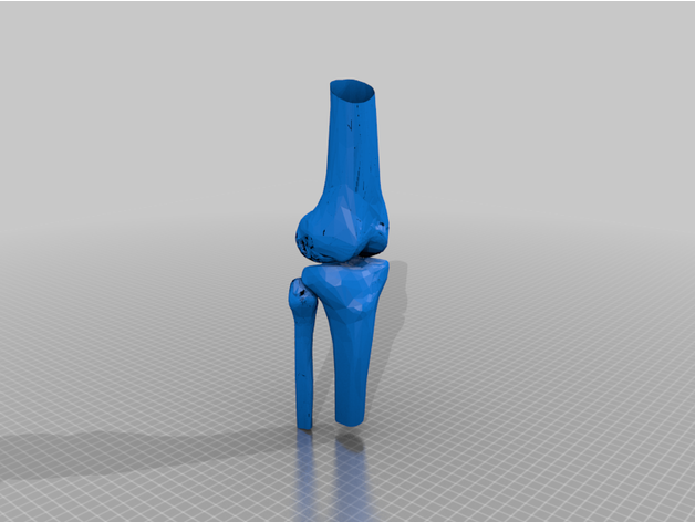 knee joint 3D print model - Mito3D