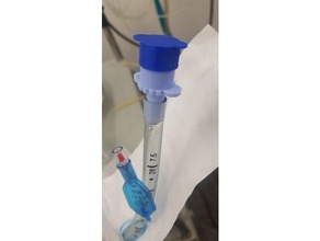 endotracheale tubo cap anestesia anestesiologia coronavirus covid 19 covid19 intubazione medico dispositivi medicinale 3d print model - Mito3D