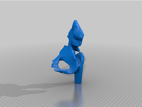 pelvis fractura 3d print model - Mito3D