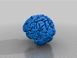 umano cervello mri medico 3d print model - Mito3D