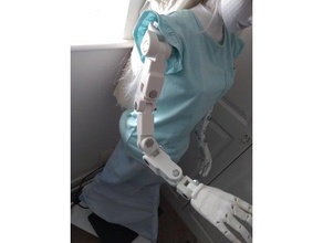 Sophie braço v2 articulado Duplo junta juntas revolta 3d print model - Mito3D