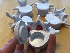 vértebras segredo compartimento espinha dorsal bodyparts3d osso recipiente recipientes Bruxas suporte lombar comprimido coluna armazenamento 3d print model - Mito3D