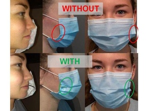 chirurgical masque rétracteur ecarteur mascarade chirurgique covid19 3d print model - Mito3D