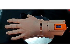 remix cinétique main robotique bionique médical dispositifs 3d print model - Mito3D