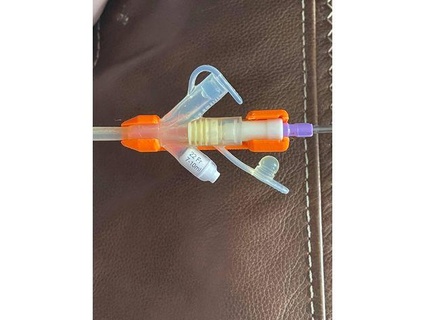gj feeding tube retainer jridley 3d print model - Mito3D