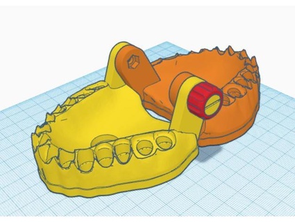 dentadura mordeu suporte rte 3d print model - Mito3D
