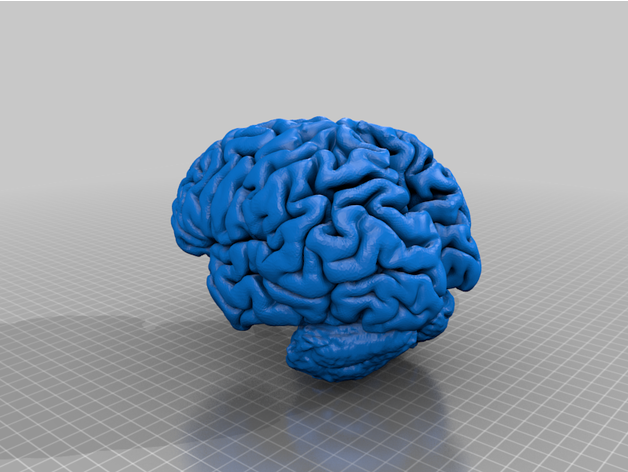 mri cérebro modelo 3D print model - Mito3D