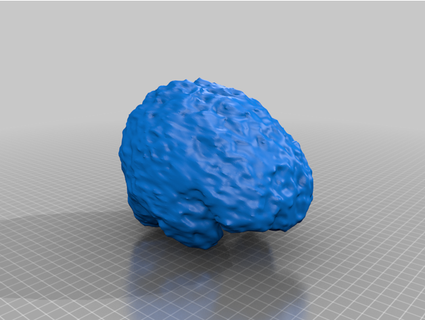 Gehirn mobius8240 3d print model - Mito3D