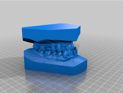 classe iii malocclusion occlusion makersoup 3d print model - Mito3D