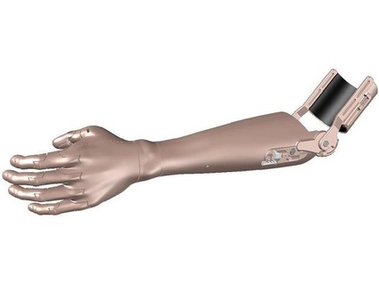 niop tr-s transradial prosthetic device 3d print model - Mito3D