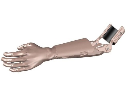 niop tr transradial prosthetic device 3d print model - Mito3D