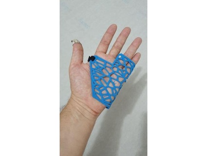 pinky splint cartoleba 3d print model - Mito3D