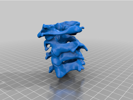 cervical vertebrae jschillingl 3d print model - Mito3D