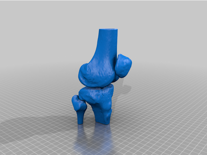 genou analyse 3d fabadd academie 3d print model - Mito3D