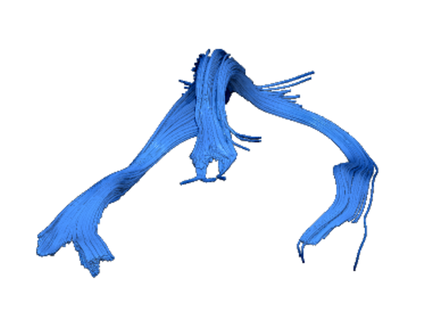 fornix white matter neuroanatomy stephforkel 3d print model - Mito3D
