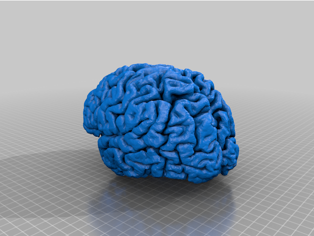 actual brain muxelmann 3D print model - Mito3D
