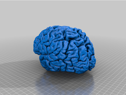 real cerebro muxelmann 3d print model - Mito3D