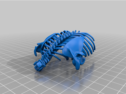 Knochen Truhe Remix einfacher Unterstützung Entfernung skrat6009 3d print model - Mito3D