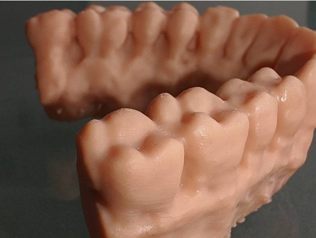 maxilla mandible dicom stl sandanielsan 3D print model - Mito3D