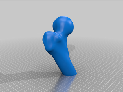 innovative design methodology patient-specific short femoral stems solor5  3d print model - Mito3D